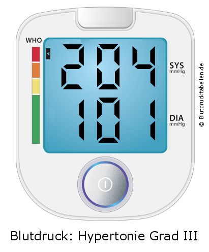 Blutdruck 204 zu 101 auf dem Blutdruckmessgerät