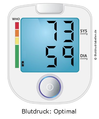 Blutdruck 73 zu 59 auf dem Blutdruckmessgerät